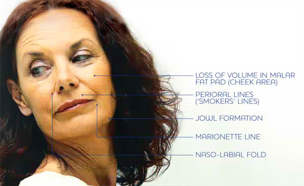 Perfect Smile Female Aging